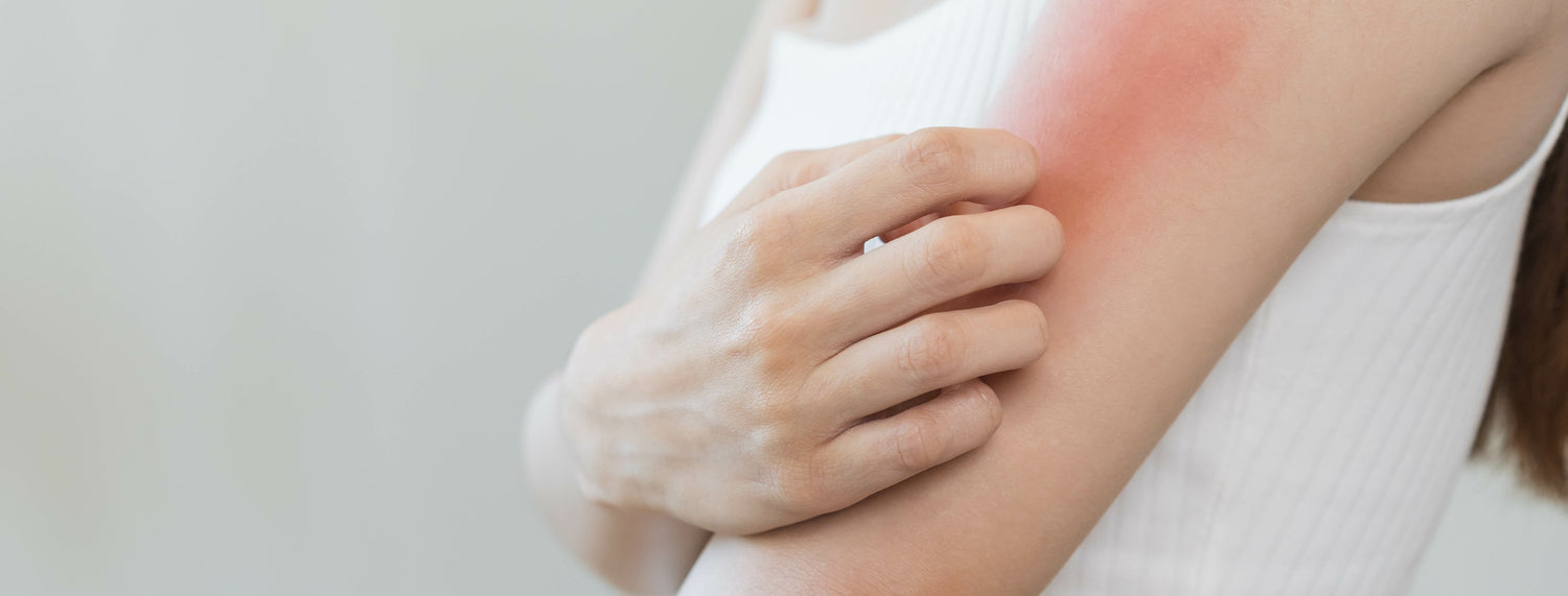 Cannabis-Allergie: Alles, was du wissen musst